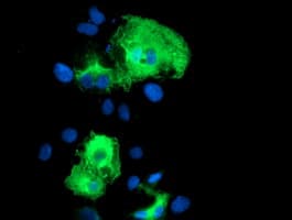 SCHIP1 Antibody (clone OTI1C8)