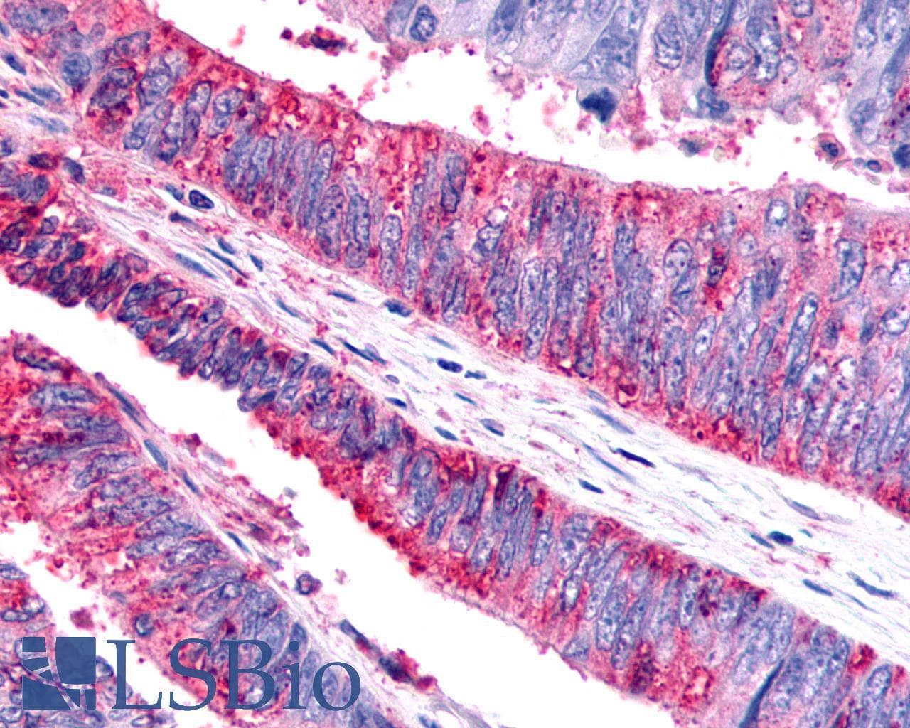 PathPlus™ CELSR1 Antibody (N-Terminus)