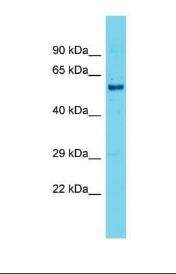 PALS2 / MPP6 Antibody (aa381-430)