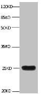 IHC-plus™ LCN2 / Lipocalin 2 / NGAL Antibody