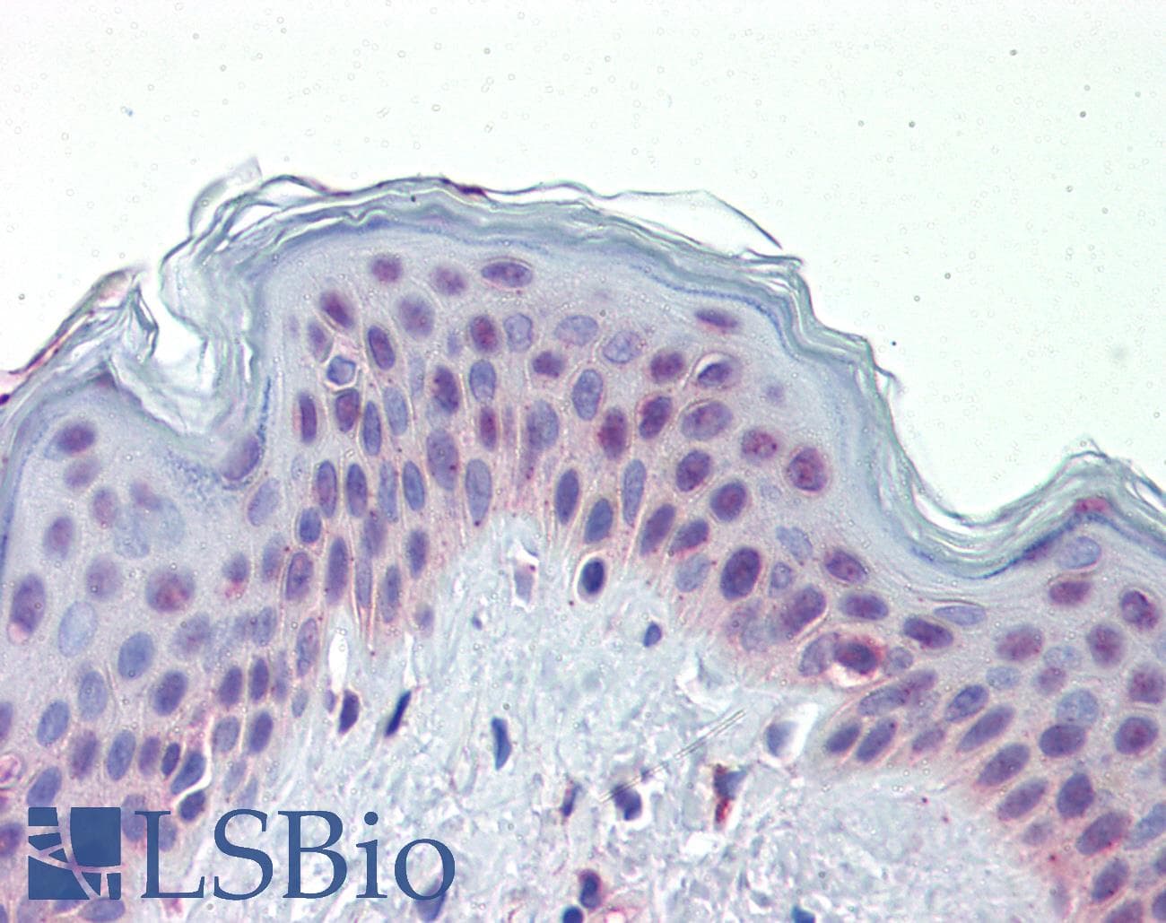 Polyclonal Rabbit anti-Human NR2C1 Antibody (N-Terminus, IHC, WB)