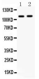 NOD1 Antibody (aa1-160)