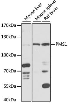 Polyclonal Rabbit anti-Human HPMS1 / PMS1 Antibody (WB)
