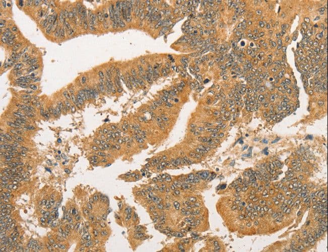 BCL2L14 / BCL-G Antibody