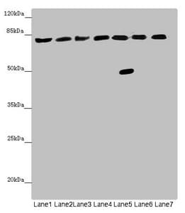 ACSL6 Antibody
