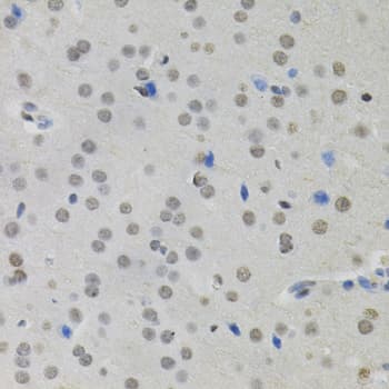 Polyclonal Rabbit anti-Human BSAC / MKL1 Antibody (IHC, WB)