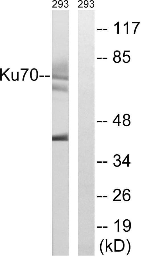 IHC-plus™ Polyclonal Rabbit anti-Human XRCC6 / Ku70 Antibody (aa1-50, IHC, WB)