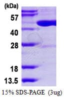 Human TRDMT1 / DNMT2 Protein (Recombinant His)