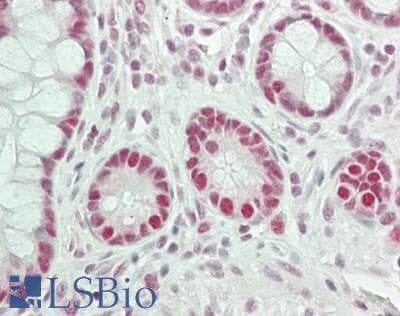 IHC-plus™ CSTF3 Antibody (aa667-717)