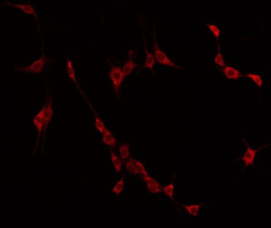 CCDC102B Antibody