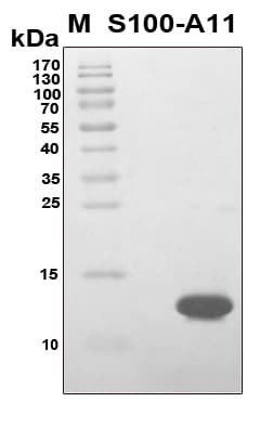 Human Calgizzarin / S100A11 Protein (Recombinant 6His, N-terminus)