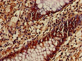 APG4B / ATG4B Antibody