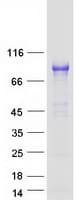 Human VCAM1 / CD106 Protein (Recombinant Myc-DDK (Flag))