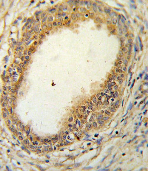 Polyclonal Rabbit anti-Human HAPLN1 Antibody (aa10-38, IHC, WB)