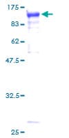 Human STAT3 Protein (Recombinant GST)