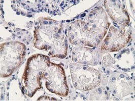 SSX1 Antibody (clone OTI1E10)