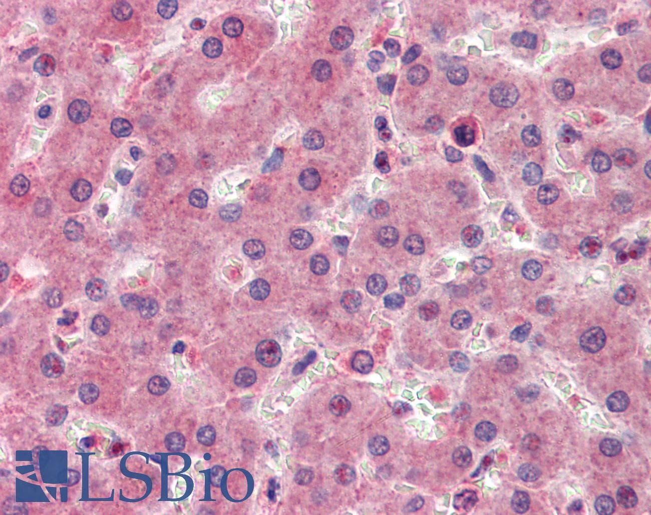 IHC-plus™ RASSF1 / RASSF1A Antibody (aa135-147)