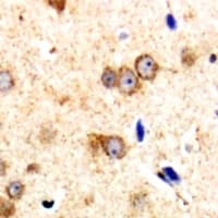 CARMA1 / CARD11 Antibody (N-Terminus)