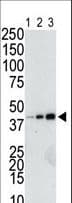 Polyclonal Rabbit GST Tag Antibody (IHC, WB)