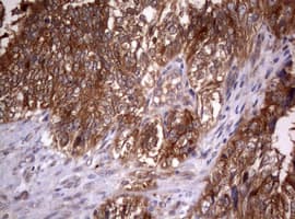 PIK3C2A Antibody (aa230-560, clone OTI1B8)