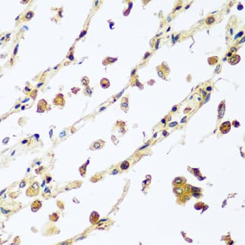 VPS4A Antibody