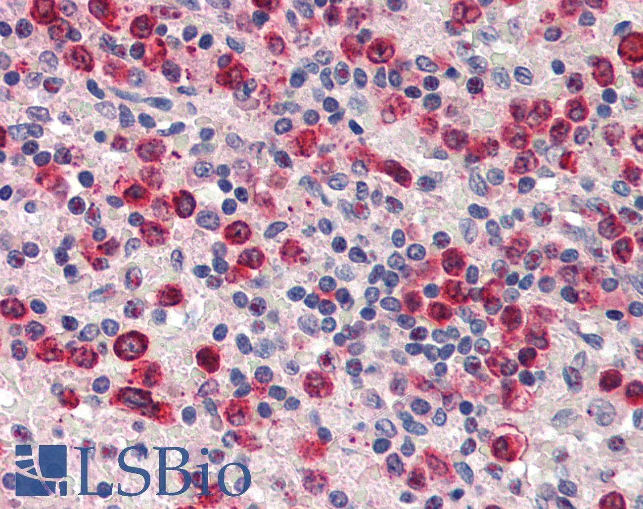 IHC-plus™ ZBTB7A / Pokemon Antibody (C-Terminus)