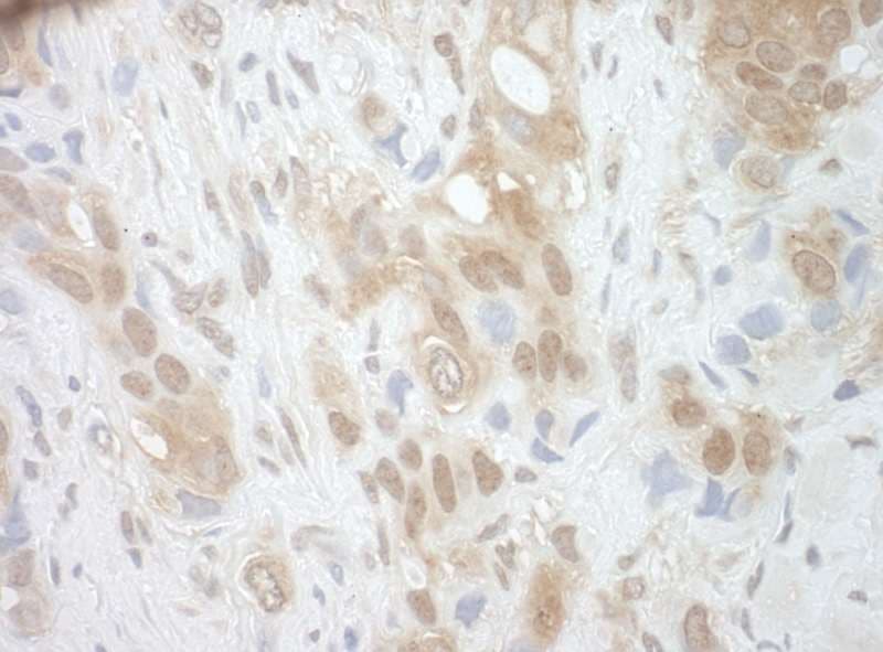 RECQ5 / RECQL5 Antibody (aa1-50)