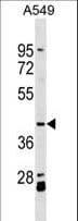 ACTL8 Antibody (aa166-192)