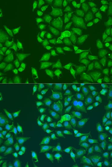 Polyclonal Rabbit anti-Human STAU2 Antibody (IF, WB)