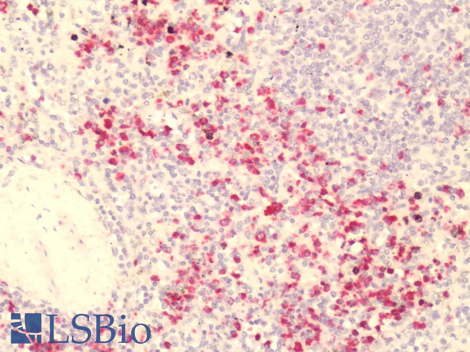 PathPlus™ GPR84 Antibody (Extracellular Domain)