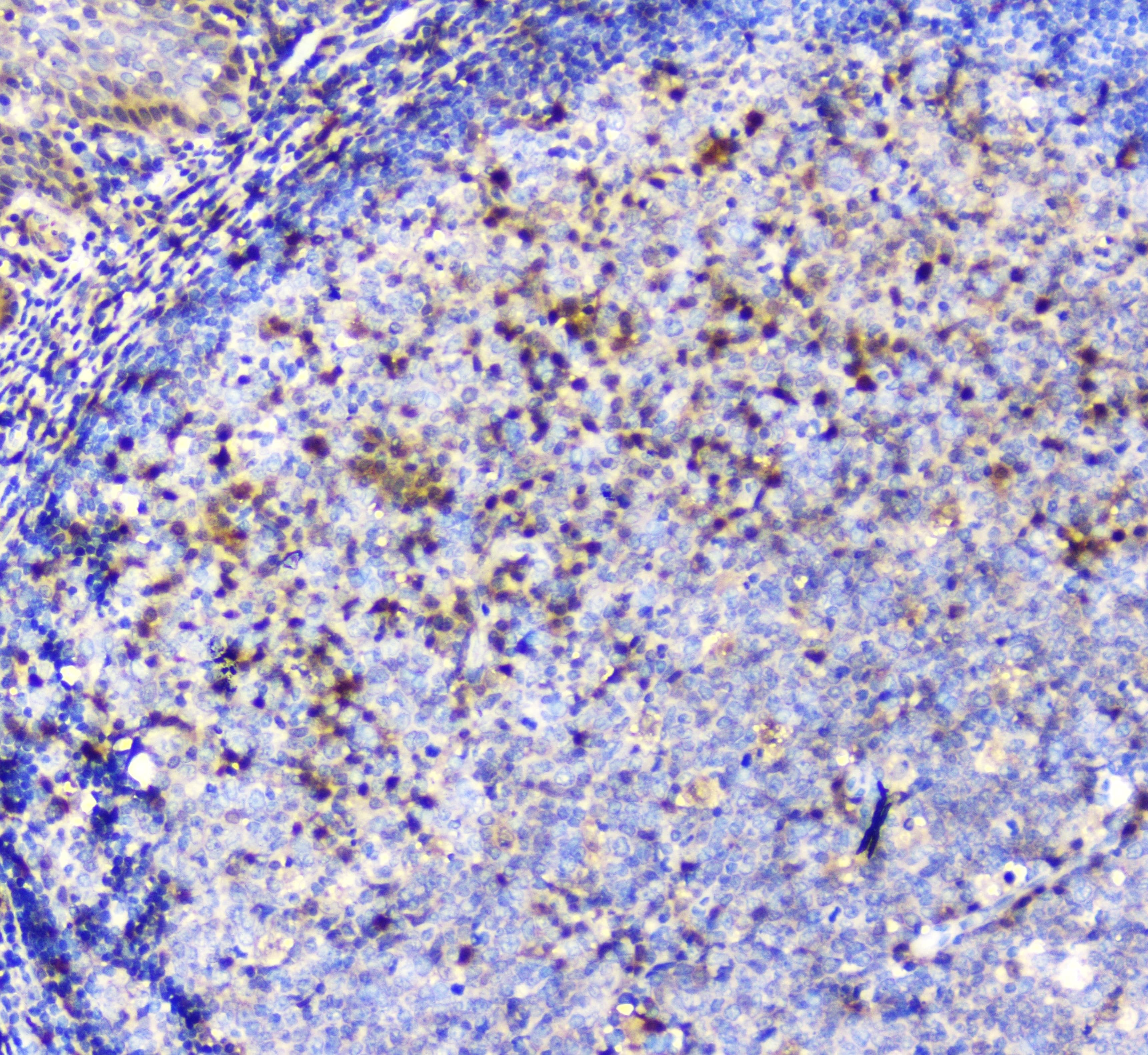ADA / Adenosine Deaminase Antibody