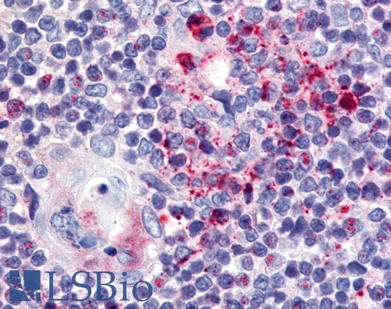 IHC-plus™ Polyclonal Rabbit anti-Human USP4 Antibody (N-Terminus, IHC, WB)