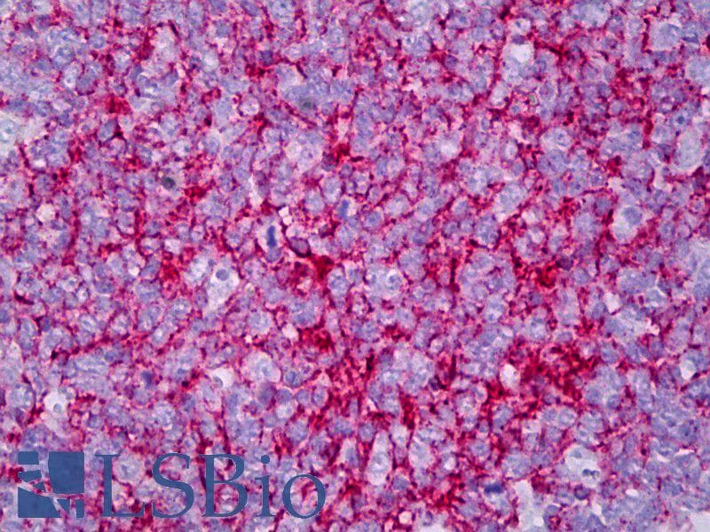 PathPlus™ Monoclonal Mouse anti-Human CR2 / CD21 Antibody (clone Bu32, IHC)