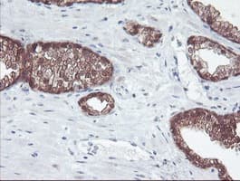 ACY1 / Aminoacylase 1 Antibody (clone OTI2F1)