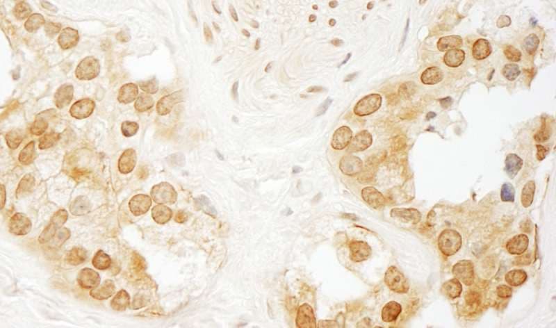 PPP3CA / CCN1 / Calcineurin A Antibody (aa470-C-term)