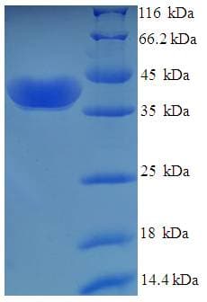 Human UCK1 Protein (Recombinant His-SUMO)