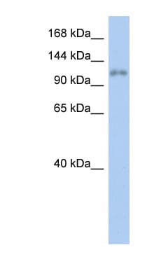 Polyclonal Rabbit anti-Human ZNF217 Antibody (aa71-120, WB)