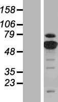 Human PKM / Pyruvate Kinase, Muscle Protein (Over-Expression Lysate Myc-DDK (Flag))