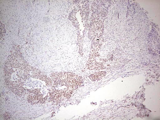 ERCC1 Antibody (clone OTI6H7)