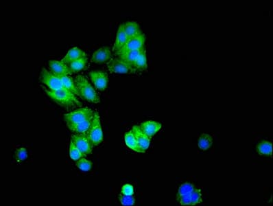 Polyclonal Rabbit anti-Human KCNIP3 / Dream / Calsenilin Antibody (IHC, IF, WB)