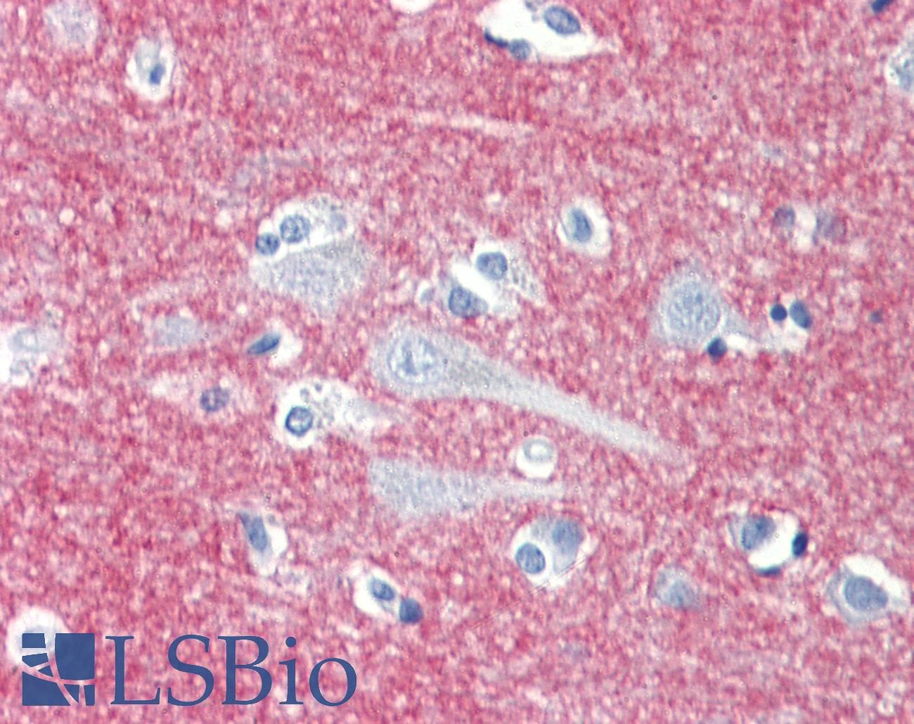 IHC-plus™ Polyclonal Rabbit anti-Human SIRPA / CD172a Antibody (IHC, WB)