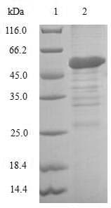 Human BIRC8 / ILP2 Protein (Recombinant GST, N-terminus)