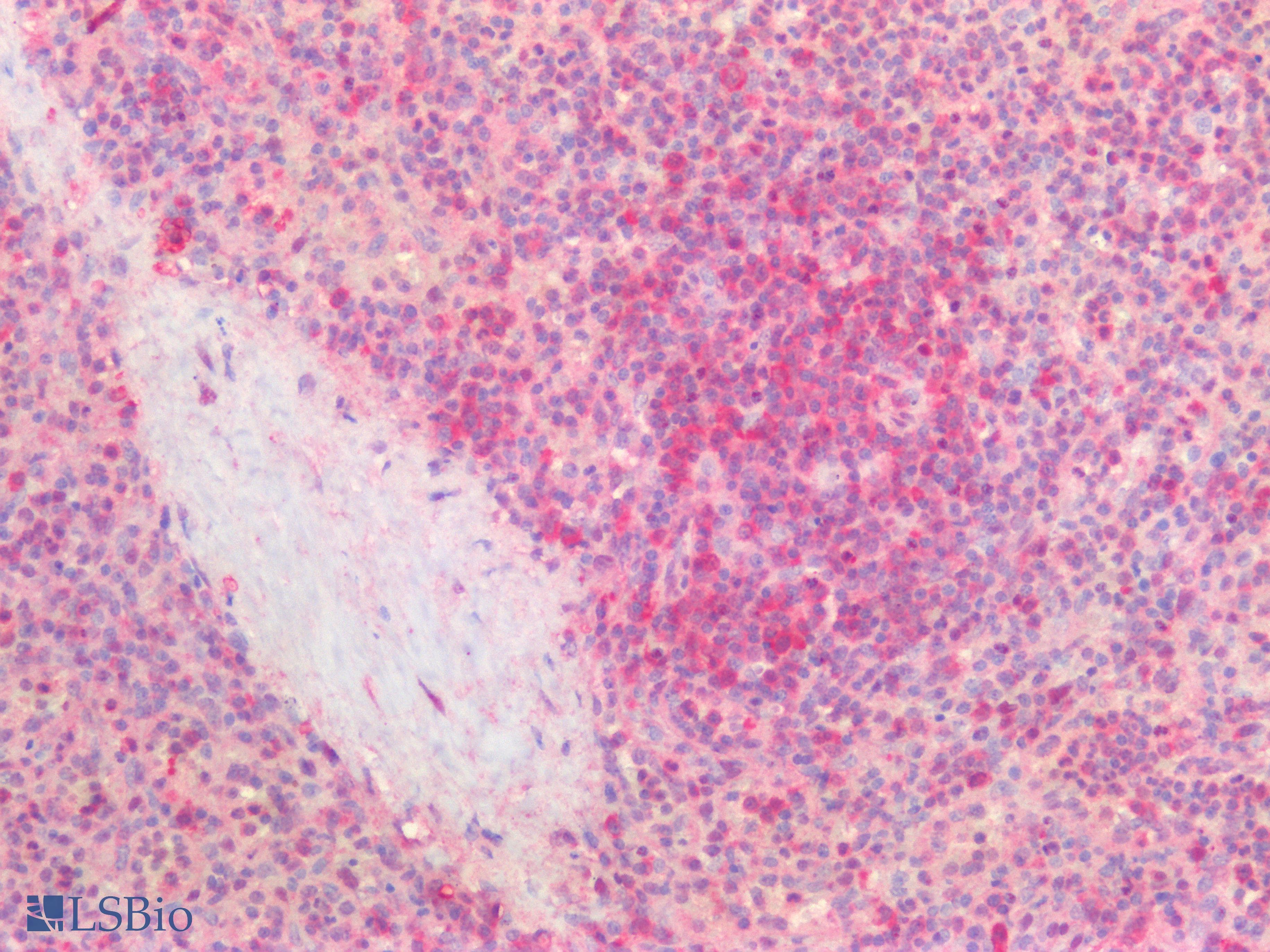 PathPlus™ LDHA / LDH1 Antibody