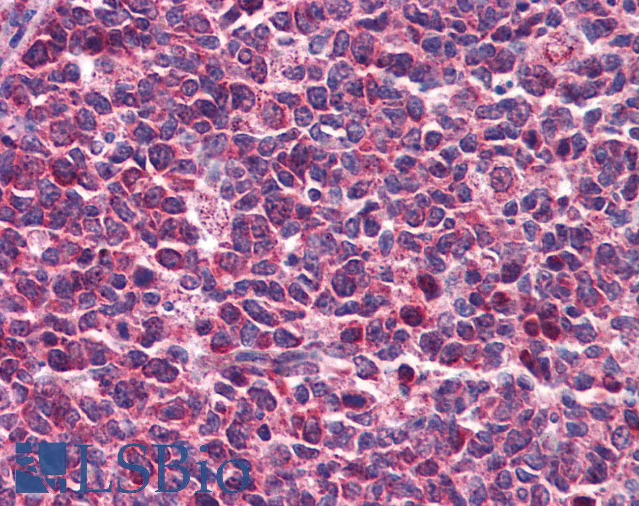 DENND1B Antibody (aa144-193, HRP)