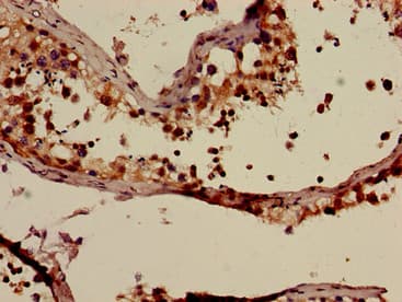 IHC-plus™ SUR2 / ABCC9 Antibody
