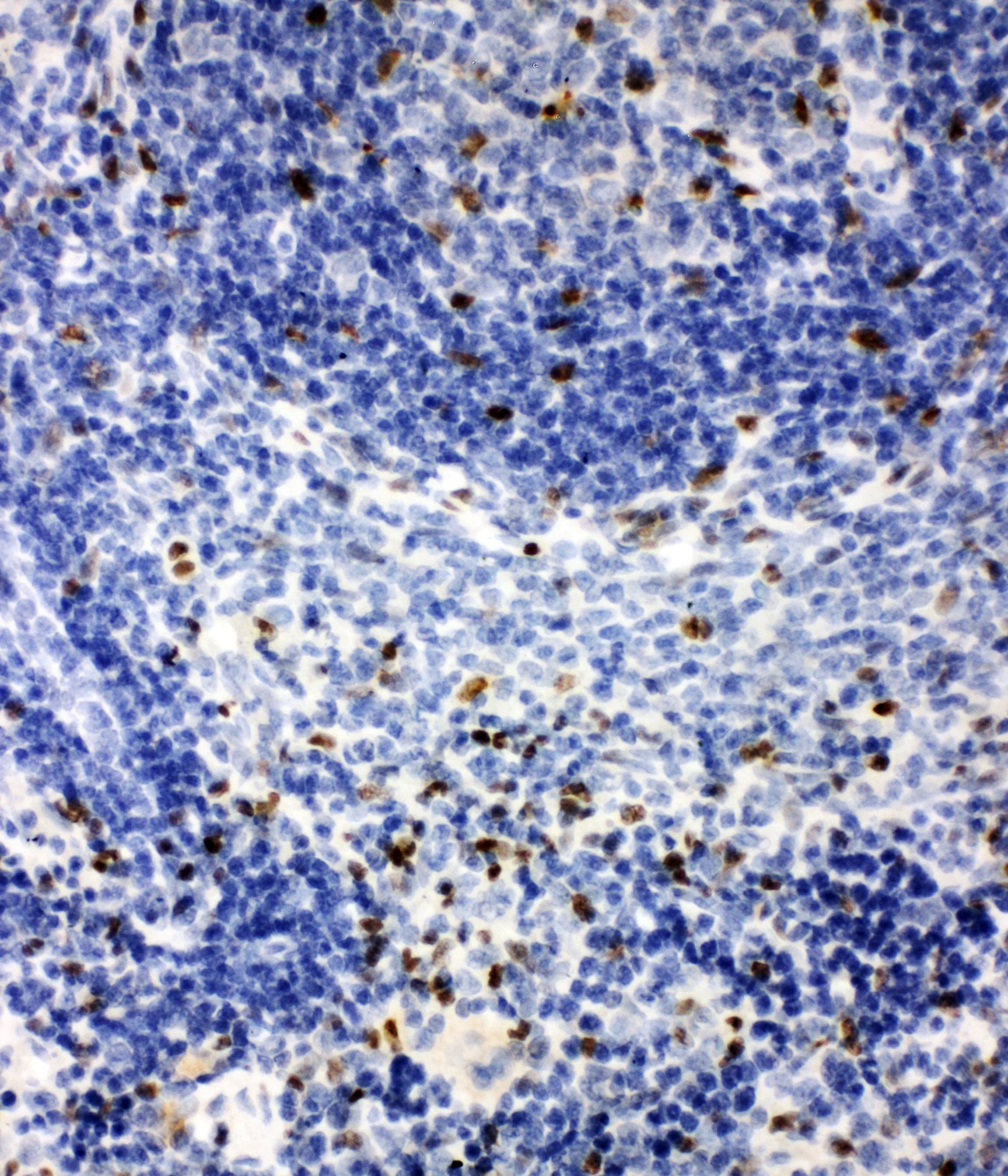 IRAK2 / IRAK-2 Antibody (aa600-616)