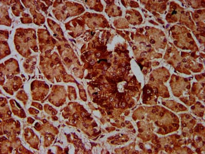 Polyclonal Rabbit anti-Human IMPDH1 Antibody (IHC, IF)