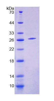 Human ENOX2 Protein (Recombinant His-T7)