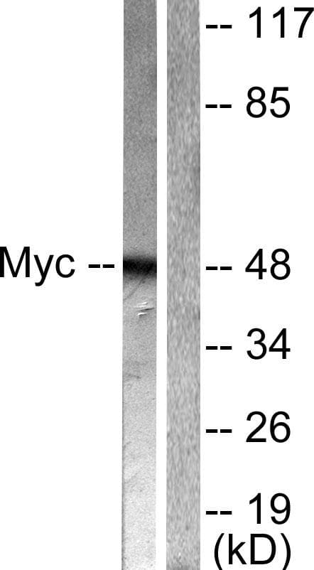 Polyclonal Rabbit anti-Human MYC / c-Myc Antibody (p62, IHC, IF, WB)