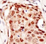 CBLC Antibody (aa424-453)